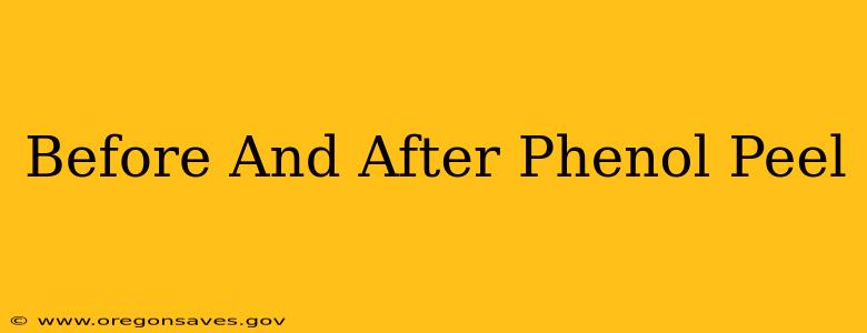 Before And After Phenol Peel
