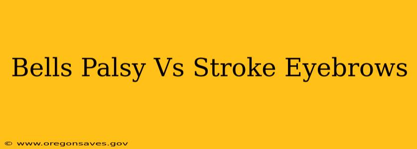 Bells Palsy Vs Stroke Eyebrows
