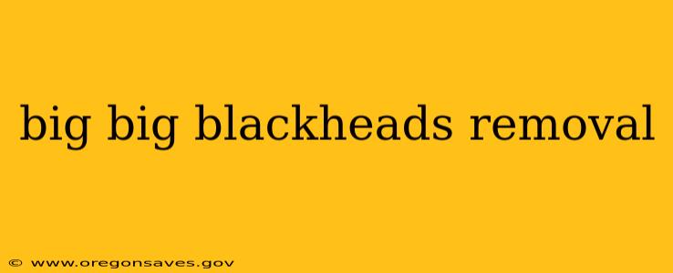 big big blackheads removal