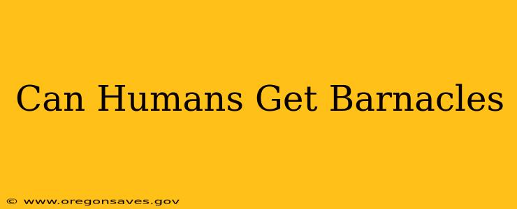 Can Humans Get Barnacles