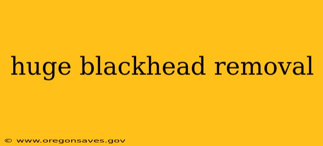 huge blackhead removal
