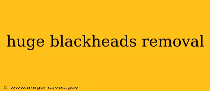 huge blackheads removal