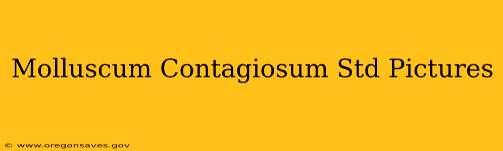 Molluscum Contagiosum Std Pictures
