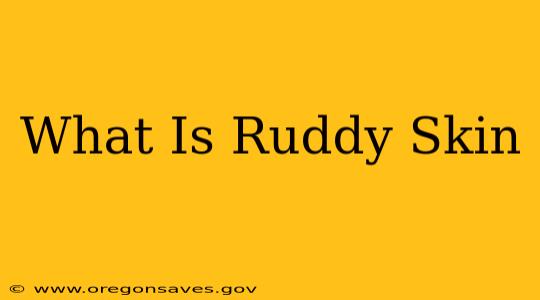 What Is Ruddy Skin